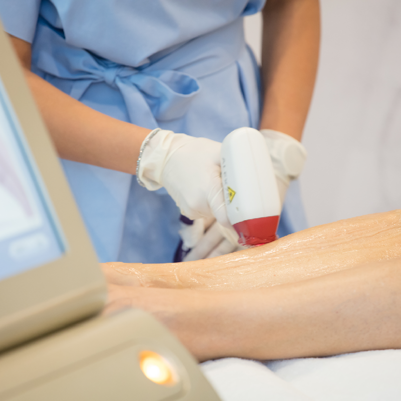 Moderne Lasertherapie zur gezielten Behandlung von Hautveränderungen – medizinisch fundiert, präzise und schonend.