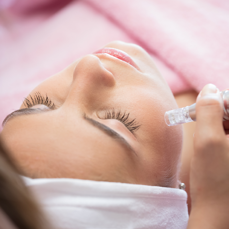 Microneedling mit Radiofrequenz (RF) in München