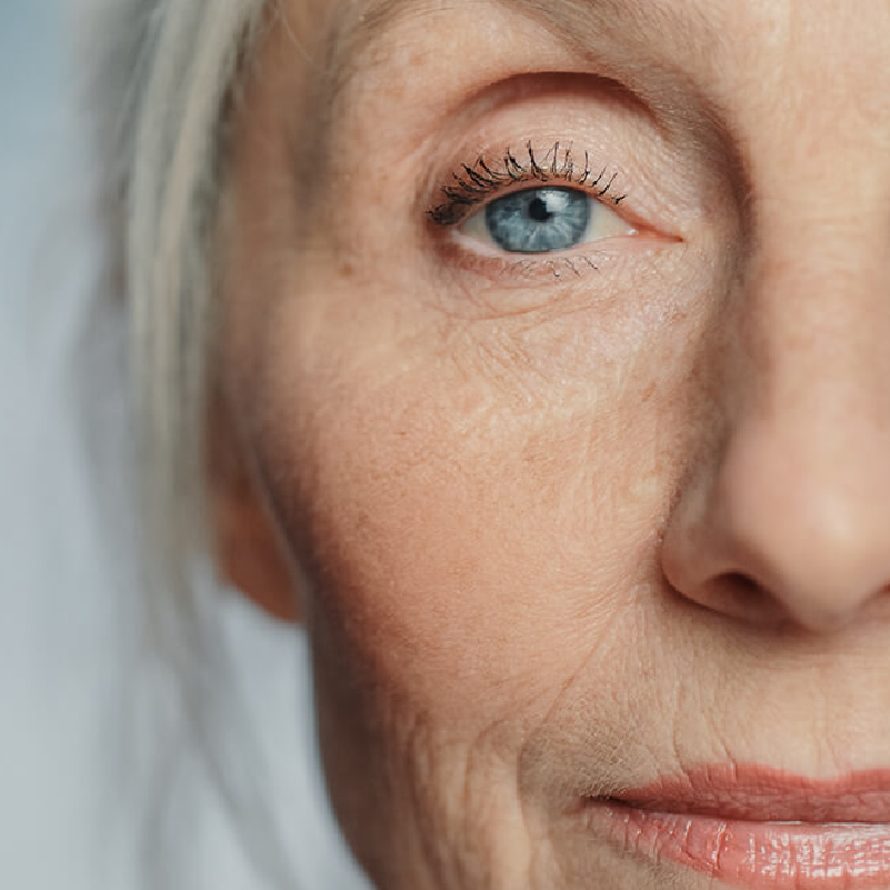 Faltenbehandlung München – Dermatologie im Schlosspalais