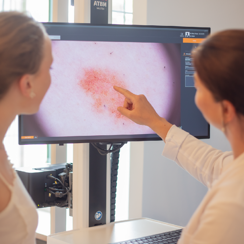 Hautkrebs-Screening München | Ihre Hautkrebsvorsorge